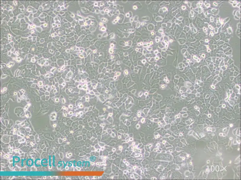 NCI-H2126 Cell Complete Medium - 1