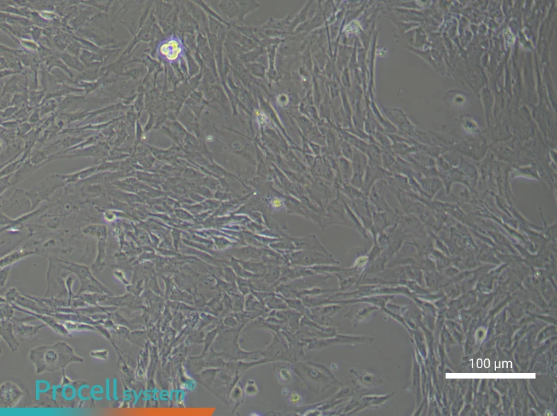 Mouse Cerebral Artery Smooth Muscle Cell Complete Medium - 1