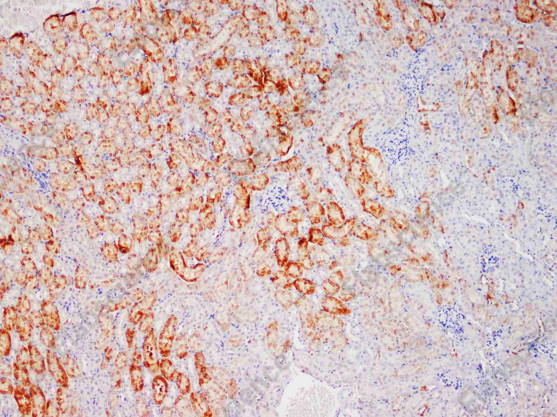 Recombinant NQO1 Monoclonal Antibody - 2