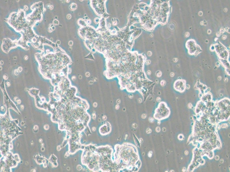 NCI-H209 [H209] Cell Complete Medium - small - 6