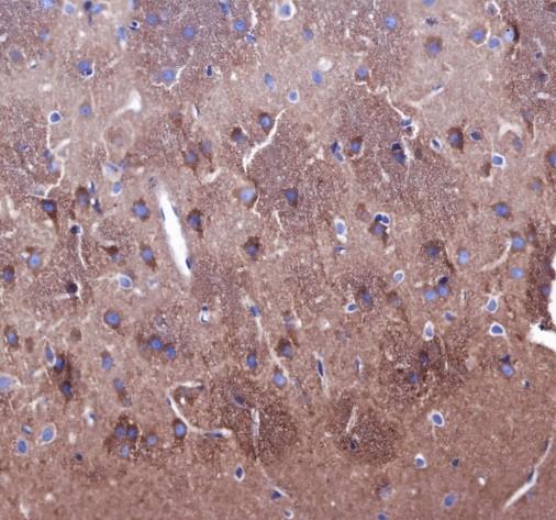 Recombinant ROCK2+ROCK1 Monoclonal Antibody - small - 4