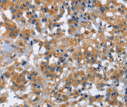 IL2RB Polyclonal Antibody - 2