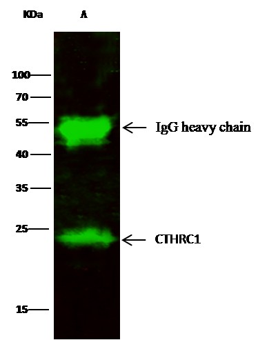 Recombinant CTHRC1 Monoclonal Antibody - small - 1
