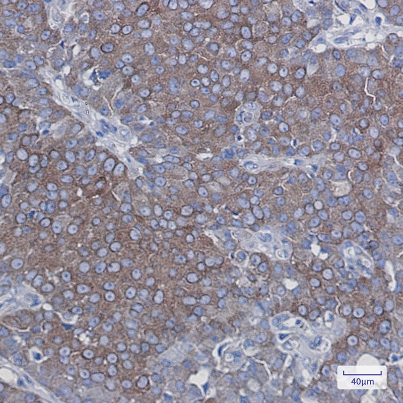 Recombinant GPCR LGR6 Monoclonal Antibody - 3