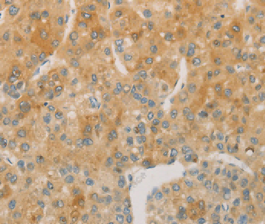 ACSL4 Polyclonal Antibody - 2