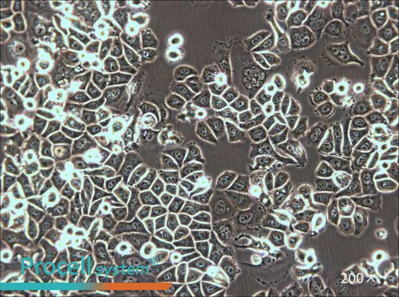 AU565 Cell Complete Medium - small - 5