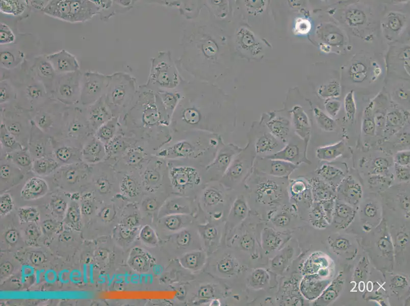 NIH:OVCAR-3 [OVCAR3] Cell Complete Medium - small - 5
