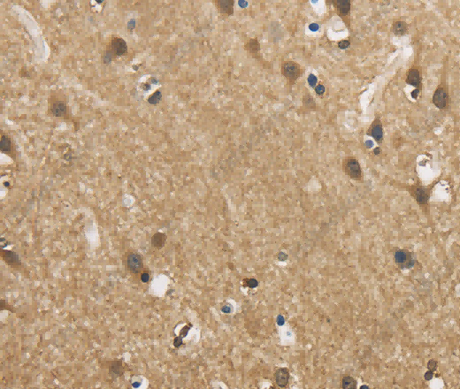 GAS7 Polyclonal Antibody - 3
