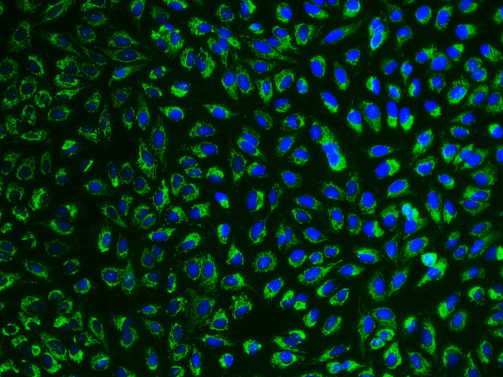 HSP-60 Polyclonal Antibody - small - 9