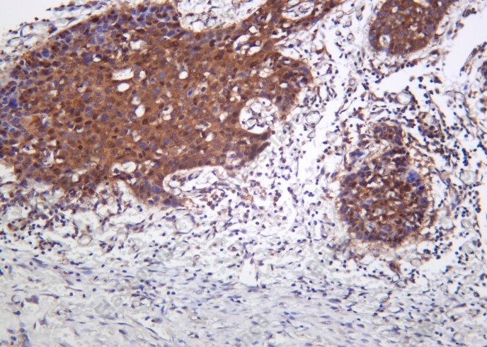 Recombinant PAKγ Monoclonal Antibody - 2