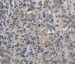 MCM3AP Polyclonal Antibody - 3