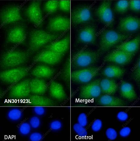 Recombinant Rab8A Monoclonal Antibody - 5