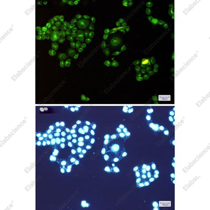 Recombinant Rab8A Monoclonal Antibody - 4