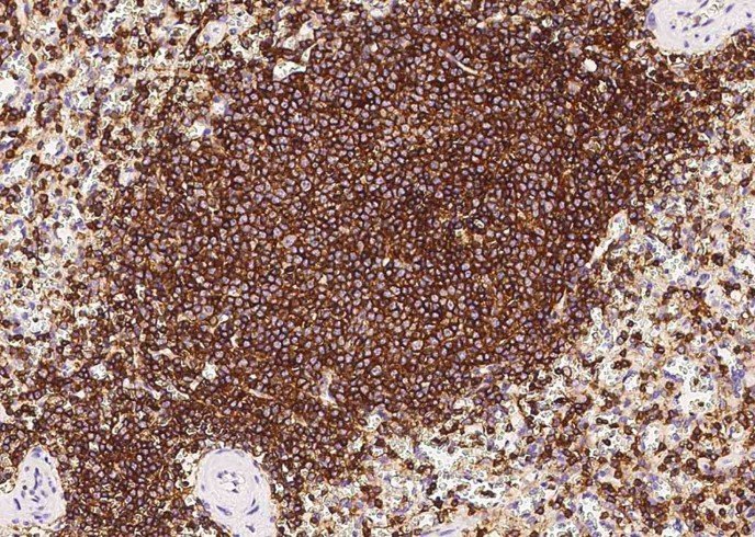 CD45/Ptprc Monoclonal Antibody - small - 2