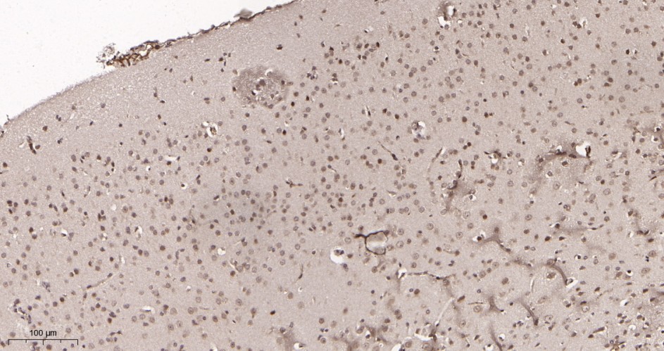 Recombinant p27 KIP 1 Monoclonal Antibody - small - 3