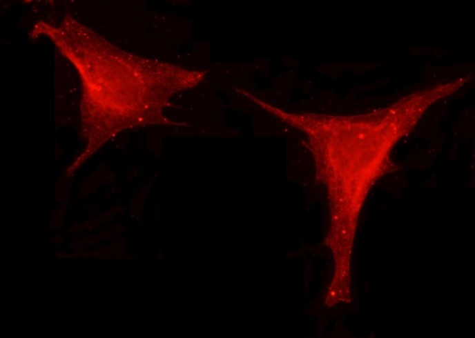 Recombinant Leptin/LEP Monoclonal Antibody - small - 2