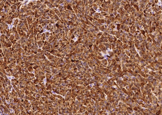 Recombinant S100B Monoclonal Antibody-searchlist-1