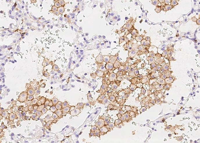 CD16b/FCGR3B Monoclonal Antibody - small - 3