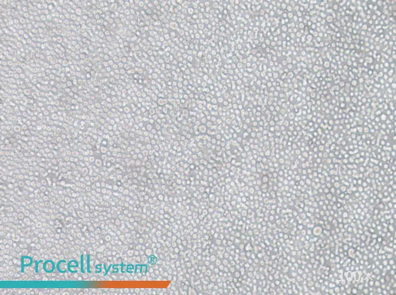 YT Cell Complete Medium - 3