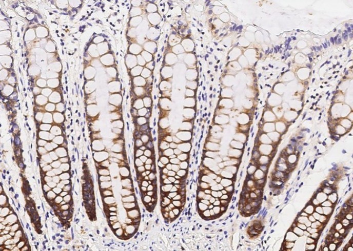 SRPK1 Monoclonal Antibody - small - 2
