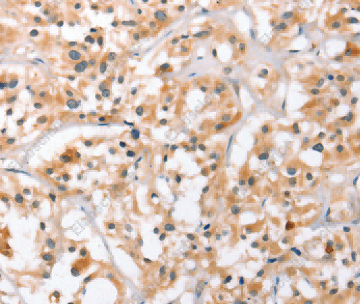 HDAC8 Polyclonal Antibody - 3
