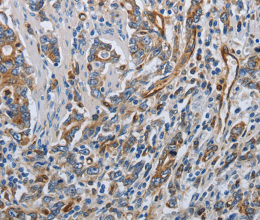 SOCS1 Polyclonal Antibody - 3
