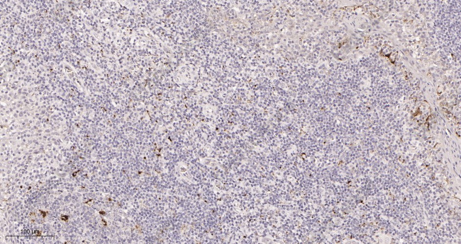 Recombinant FAK Monoclonal Antibody - 2