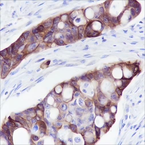 Recombinant Keratin 5/6 Monoclonal Antibody - small - 3