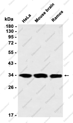 Recombinant USF1 Monoclonal Antibody - 1