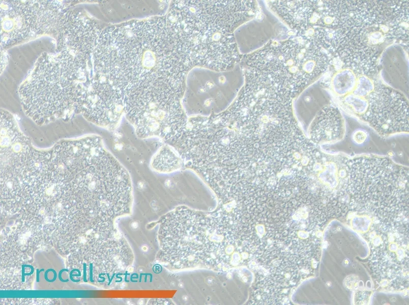 NCI-N87 [N87] Cell Complete Medium - 1