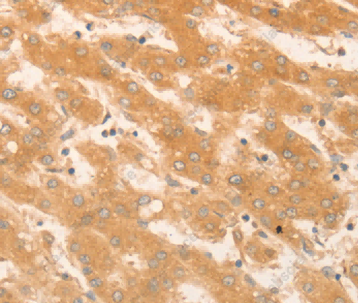 NAP1L1 Polyclonal Antibody - 2
