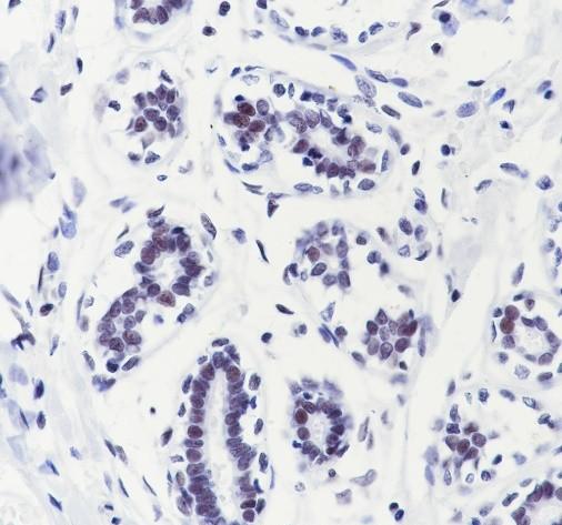 Recombinant CHD4 Monoclonal Antibody - 2