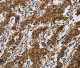 IL17RB Polyclonal Antibody - 2