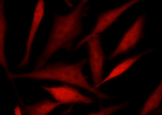 Recombinant TSC22D1 Monoclonal Antibody-searchlist-1