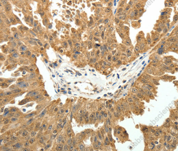 PTCH1 Polyclonal Antibody - 2