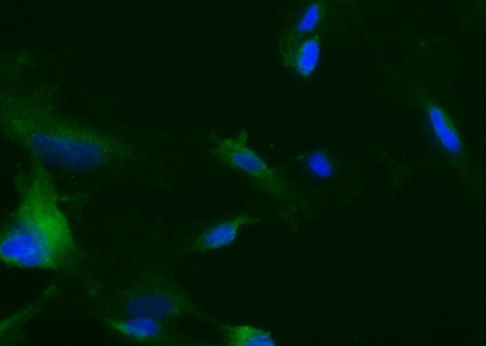 Recombinant Tie2/CD202b/TEK Monoclonal Antibody - small - 2