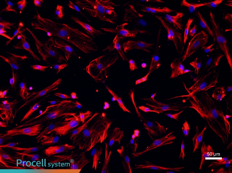 Mouse Dermal Fibroblasts - 1