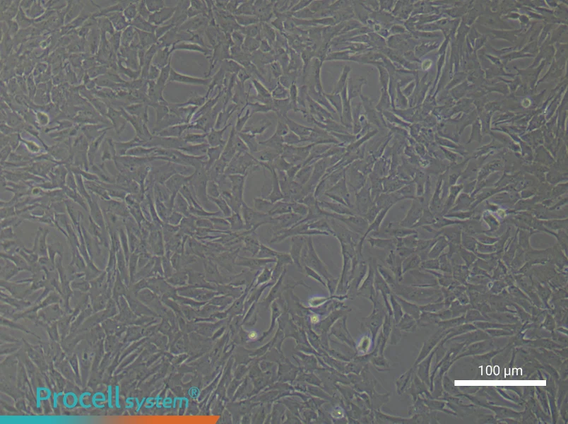 Rat Pulmonary Arteriolar Smooth Muscle Cell Complete Medium - 1
