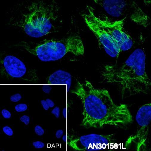 Recombinant Keratin 5/6 Monoclonal Antibody - small - 7