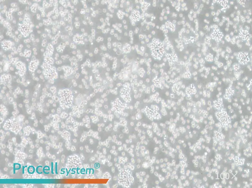 SU-DHL-6 Cell Complete MediumSU-DHL-6 Cell Complete Medium - 3
