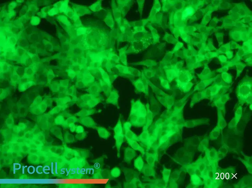 Panc02-GFP - 6