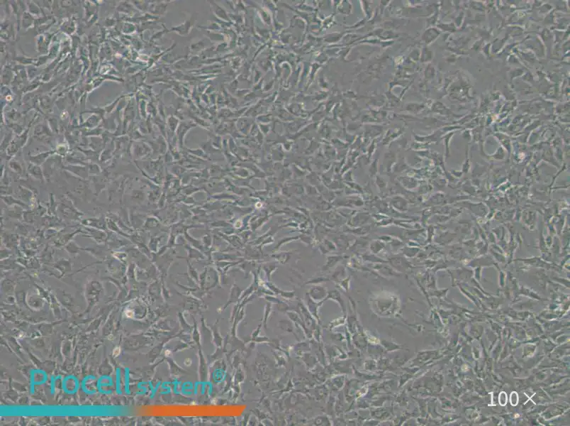 Tb 1 Lu Cell Complete MediumTb 1 Lu Cell Complete Medium - 2