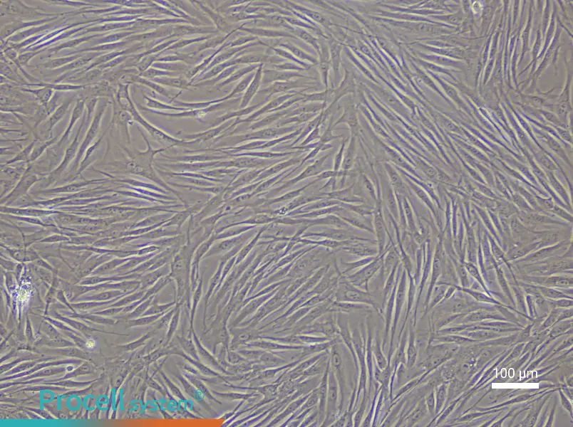 Human Umbilical Vein Smooth Muscle Cell Complete Medium - 2