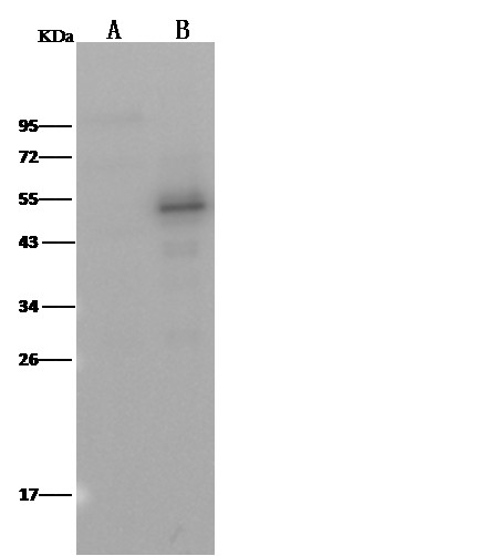 Recombinant PTP1B/PTPN1 Monoclonal Antibody - small - 3
