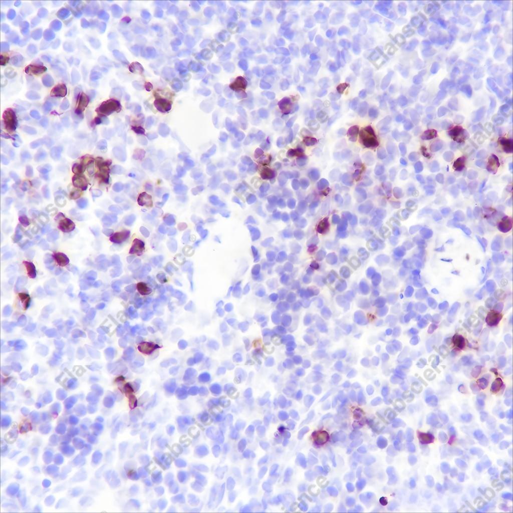Recombinant S100A8 Monoclonal Antibody - 4