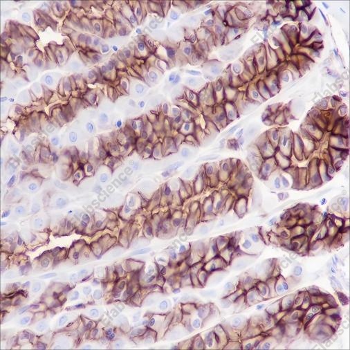 Recombinant Phospho-Girdin (Tyr1765) Monoclonal Antibody - 4