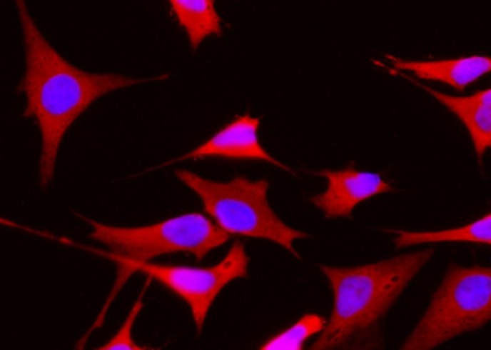 NME1/NDKA Monoclonal Antibody - small - 2