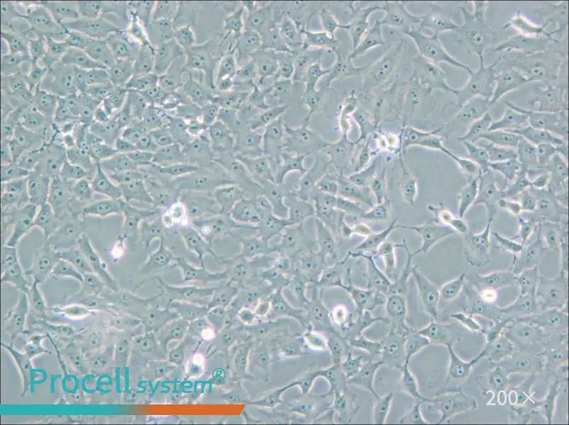 Mv.1.Lu [NBL-7] Cell Complete Medium - 5