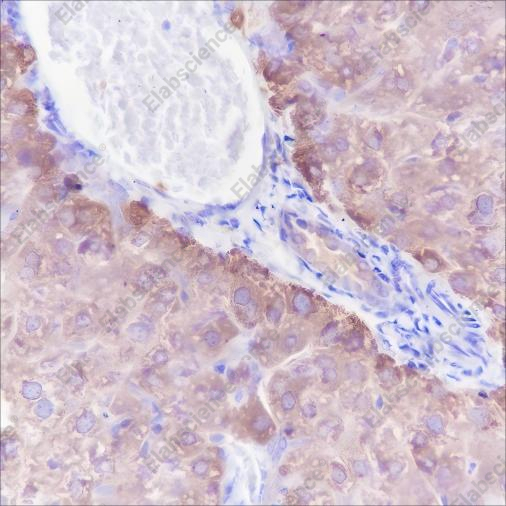 Recombinant CTEN Monoclonal Antibody - 2