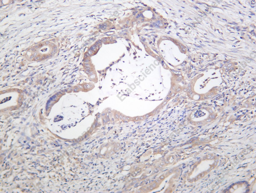 Recombinant mTOR Monoclonal Antibody - 4
